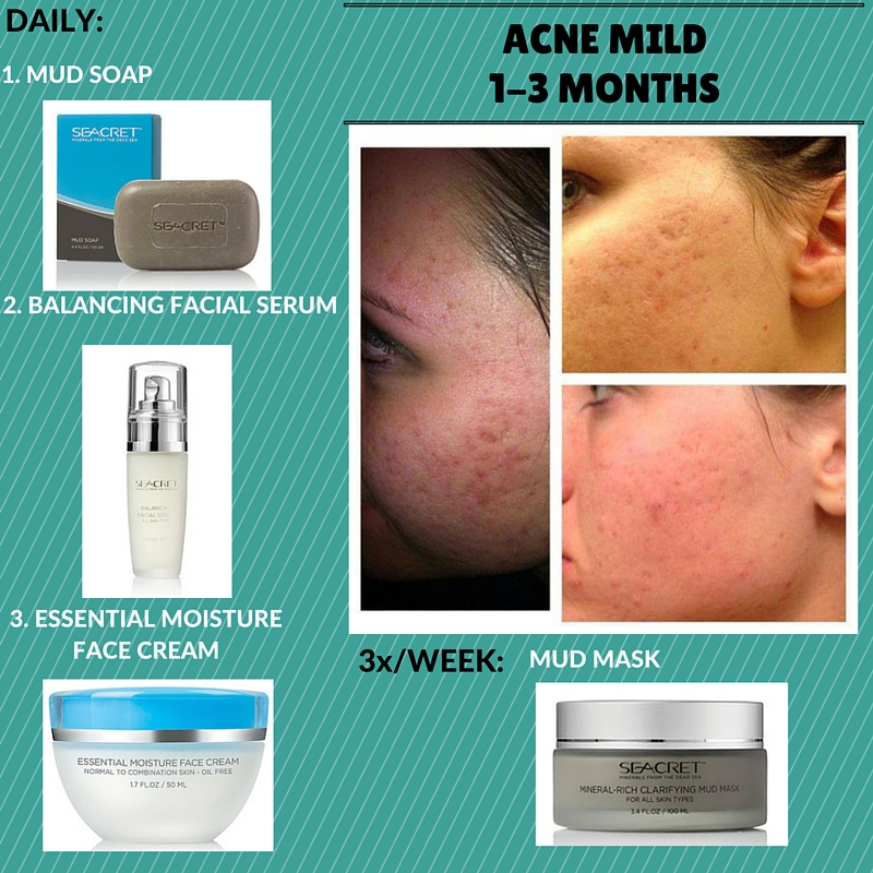 Secret Skin Care Mild Acne Regimen