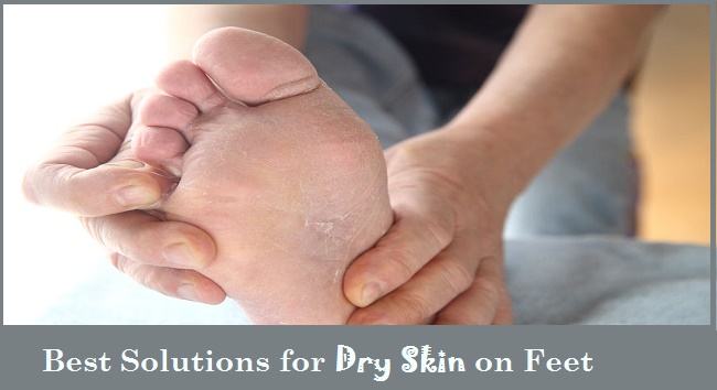 Dry Skin on Feet