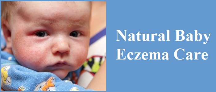 Natural Baby Eczema Care