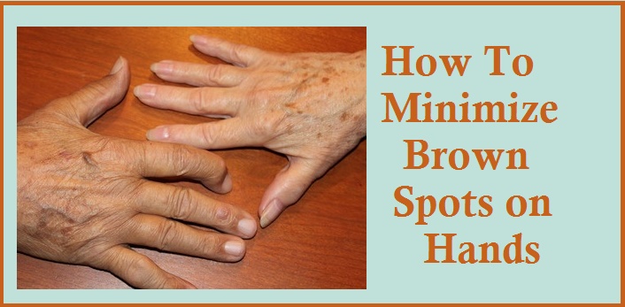 Brown Spots on Hands
