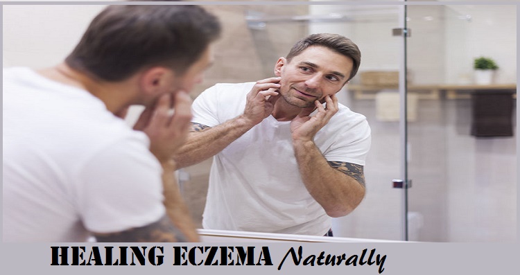 Healing Eczema Naturally