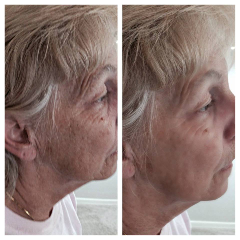 Natural Aging Skin Care Results