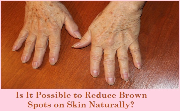 Is It Possible to Reduce Brown Spots on Skin Naturally?