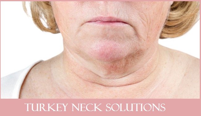 Turkey Neck Solutions